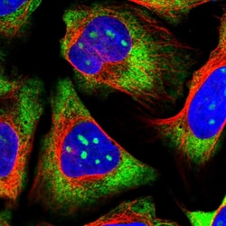 Invitrogen RPL19 Polyclonal Antibody 100 &mu;L; Unconjugated:Antibodies,