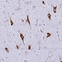 Invitrogen RPL19 Polyclonal Antibody 100 &mu;L; Unconjugated:Antibodies,