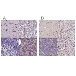 Invitrogen CASC4 Polyclonal Antibody 100 &mu;L; Unconjugated:Antibodies,