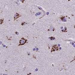 Invitrogen CASC4 Polyclonal Antibody 100 &mu;L; Unconjugated:Antibodies,