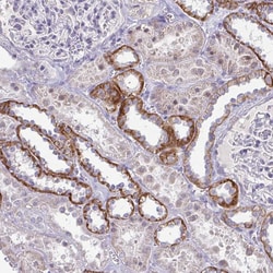 RNaseH1 Polyclonal Antibody:Antibodies, Polyclonal