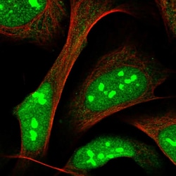 Invitrogen ZNF668 Polyclonal Antibody 100 &mu;L; Unconjugated:Antibodies,