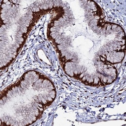 Invitrogen ZNF668 Polyclonal Antibody 100 &mu;L; Unconjugated:Antibodies,