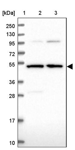 Invitrogen BPIFB6 Polyclonal Antibody 100 &mu;L; Unconjugated:Antibodies,