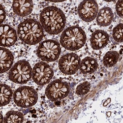 Invitrogen UQCRB Polyclonal Antibody 100 &mu;L; Unconjugated:Antibodies,