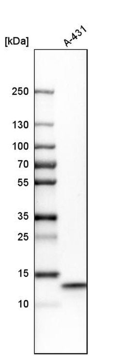 Invitrogen UQCRB Polyclonal Antibody 100 &mu;L; Unconjugated:Antibodies,