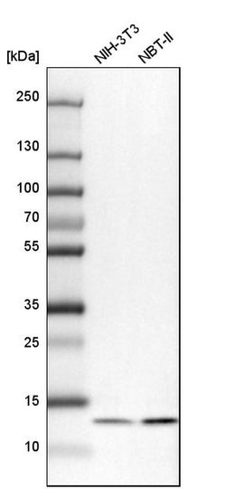 Invitrogen UQCRB Polyclonal Antibody 100 &mu;L; Unconjugated:Antibodies,