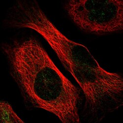 Invitrogen C5orf22 Polyclonal Antibody 100 &mu;L; Unconjugated:Antibodies,