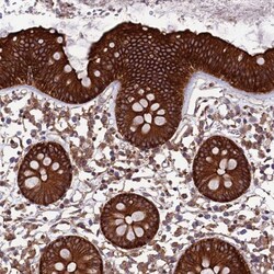 Invitrogen TNIP3 Polyclonal Antibody 100 &mu;L; Unconjugated:Antibodies,
