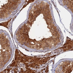 Invitrogen ARL2BP Polyclonal Antibody 100 &mu;L; Unconjugated:Antibodies,