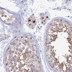 Invitrogen HS2ST1 Polyclonal Antibody 100 &mu;L; Unconjugated:Antibodies,