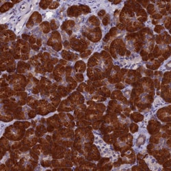 Invitrogen NOL10 Polyclonal Antibody 100 &mu;L; Unconjugated:Antibodies,