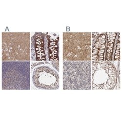 SORBS1 Polyclonal Antibody:Antibodies, Polyclonal