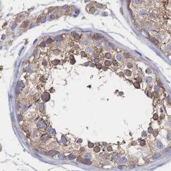 SORBS1 Polyclonal Antibody:Antibodies, Polyclonal