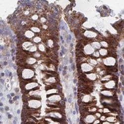 SORBS1 Polyclonal Antibody:Antibodies, Polyclonal
