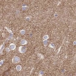 SORBS1 Polyclonal Antibody:Antibodies, Polyclonal