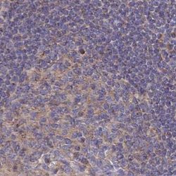 SORBS1 Polyclonal Antibody:Antibodies, Polyclonal