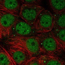 Invitrogen NSMCE1 Polyclonal Antibody 100 &mu;L; Unconjugated:Antibodies,