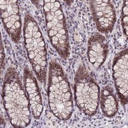 Invitrogen NSMCE1 Polyclonal Antibody 100 &mu;L; Unconjugated:Antibodies,