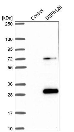 Invitrogen DEFB125 Polyclonal Antibody 100 &mu;L; Unconjugated:Antibodies,