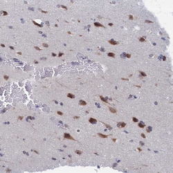 Invitrogen PGP Polyclonal Antibody 100 &mu;L; Unconjugated:Antibodies,