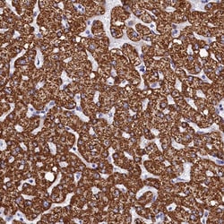 Invitrogen PGP Polyclonal Antibody 100 &mu;L; Unconjugated:Antibodies,