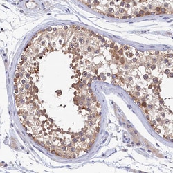 Invitrogen PGP Polyclonal Antibody 100 &mu;L; Unconjugated:Antibodies,
