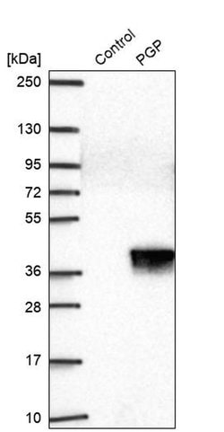 Invitrogen PGP Polyclonal Antibody 100 &mu;L; Unconjugated:Antibodies,