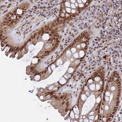 Invitrogen CCDC85A Polyclonal Antibody 100 &mu;L; Unconjugated:Antibodies,
