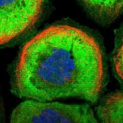 MFSD2A Polyclonal Antibody, Invitrogen&trade;
