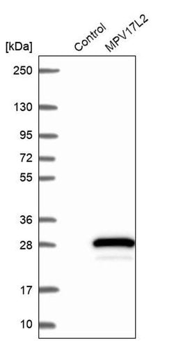 Invitrogen MPV17L2 Polyclonal Antibody 100 &mu;L; Unconjugated:Antibodies,