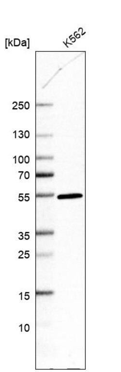 Invitrogen DDI2 Polyclonal Antibody 100 &mu;L; Unconjugated:Antibodies,