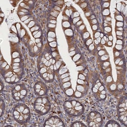 Invitrogen FILIP1L Polyclonal Antibody 100 &mu;L; Unconjugated:Antibodies,