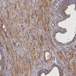Invitrogen FILIP1L Polyclonal Antibody 100 &mu;L; Unconjugated:Antibodies,