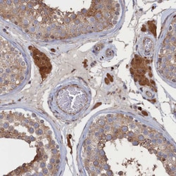 Invitrogen FILIP1L Polyclonal Antibody 100 &mu;L; Unconjugated:Antibodies,
