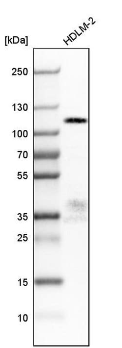 Invitrogen FILIP1L Polyclonal Antibody 100 &mu;L; Unconjugated:Antibodies,