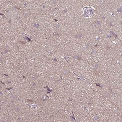 Invitrogen FSD1 Polyclonal Antibody 100 &mu;L; Unconjugated:Antibodies,