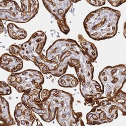 Invitrogen KIF7 Polyclonal Antibody 100 &mu;L; Unconjugated:Antibodies,