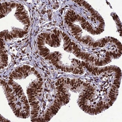 Invitrogen INO80E Polyclonal Antibody 100 &mu;L; Unconjugated:Antibodies,