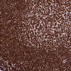 Invitrogen INO80E Polyclonal Antibody 100 &mu;L; Unconjugated:Antibodies,