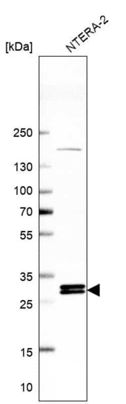 Invitrogen INO80E Polyclonal Antibody 100 &mu;L; Unconjugated:Antibodies,