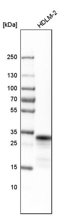 HLA-DRB5 Polyclonal Antibody:Antibodies, Polyclonal