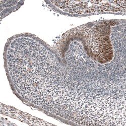 Invitrogen IRX1 Polyclonal Antibody 100 &mu;L; Unconjugated:Antibodies,