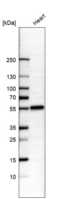 Invitrogen IRX1 Polyclonal Antibody 100 &mu;L | Buy Online | Invitrogen&trade; | Fisher Scientific