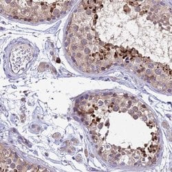 Invitrogen THAP5 Polyclonal Antibody 100 &mu;L; Unconjugated:Antibodies,