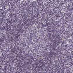 Invitrogen C14orf1 Polyclonal Antibody 100 &mu;L; Unconjugated:Antibodies,