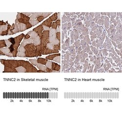 Invitrogen TNNC2 Polyclonal Antibody 100 &mu;L; Unconjugated:Antibodies,