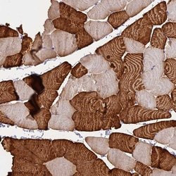 Invitrogen TNNC2 Polyclonal Antibody 100 &mu;L; Unconjugated:Antibodies,