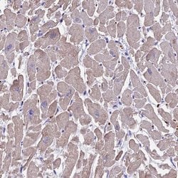 Invitrogen TNNC2 Polyclonal Antibody 100 &mu;L; Unconjugated:Antibodies,