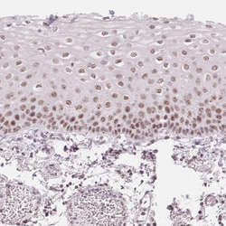 Invitrogen KLHDC9 Polyclonal Antibody 100 &mu;L; Unconjugated:Antibodies,